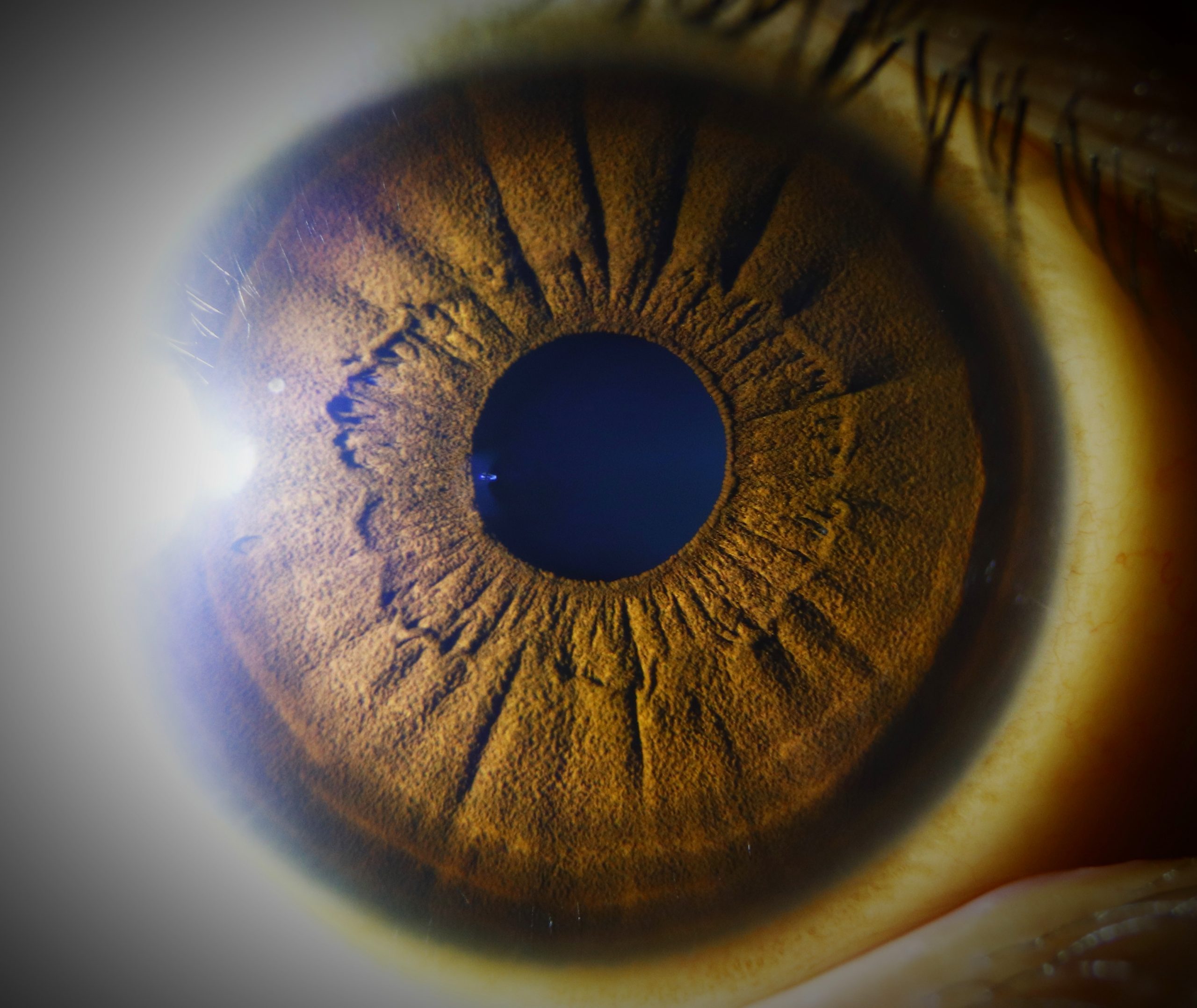 Retina of eye