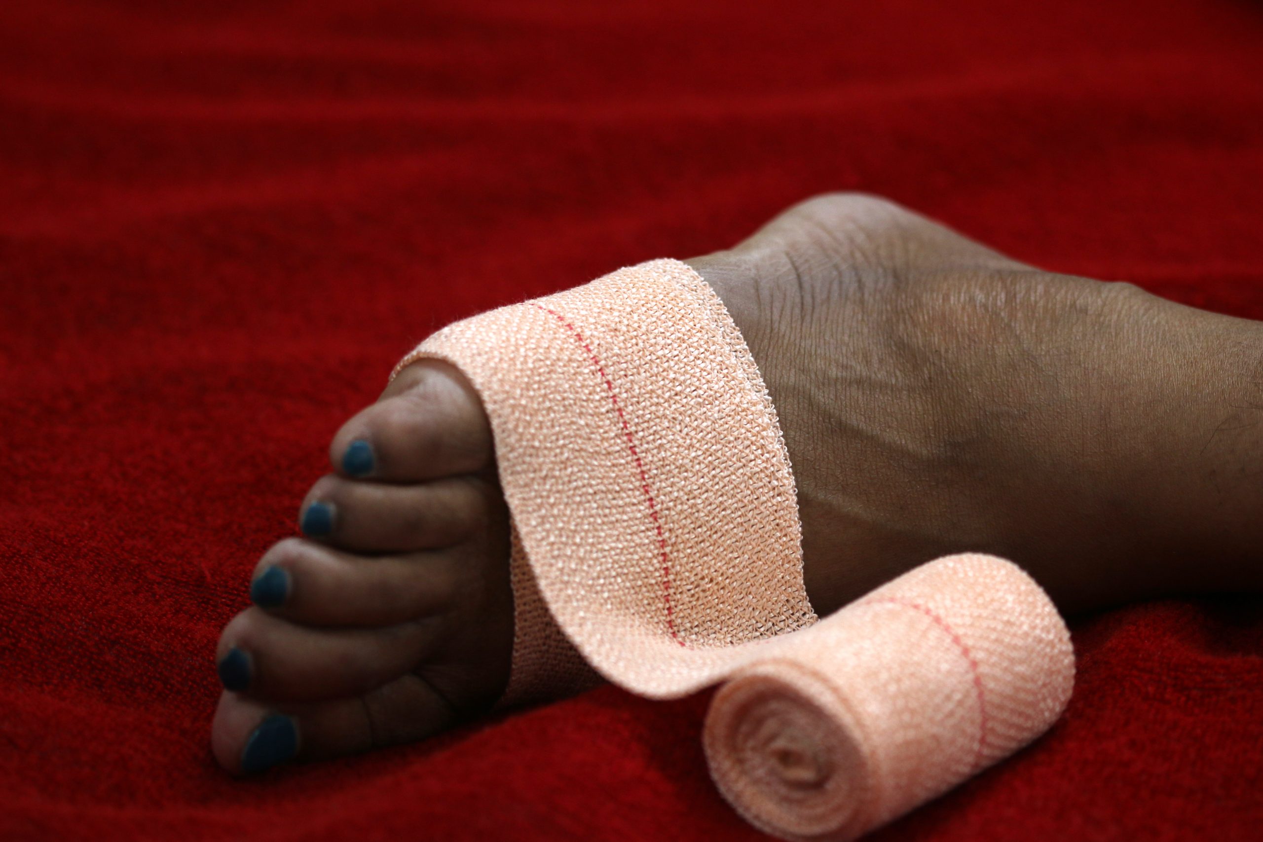 An injured foot with bandage on it.