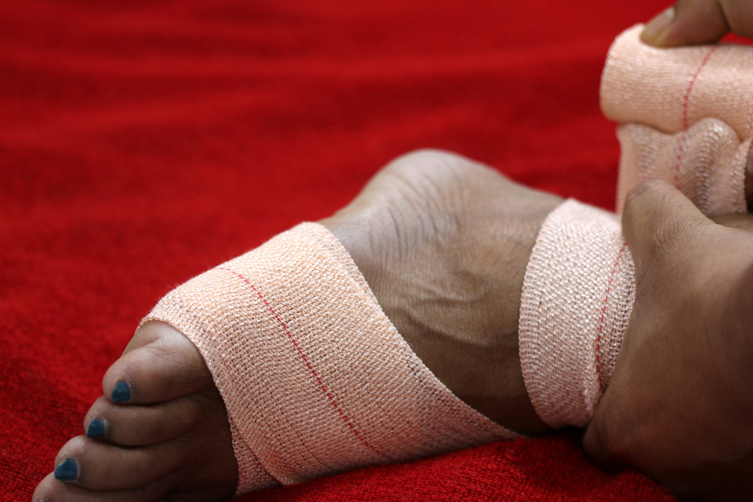 Crepe bandage for ankle strain