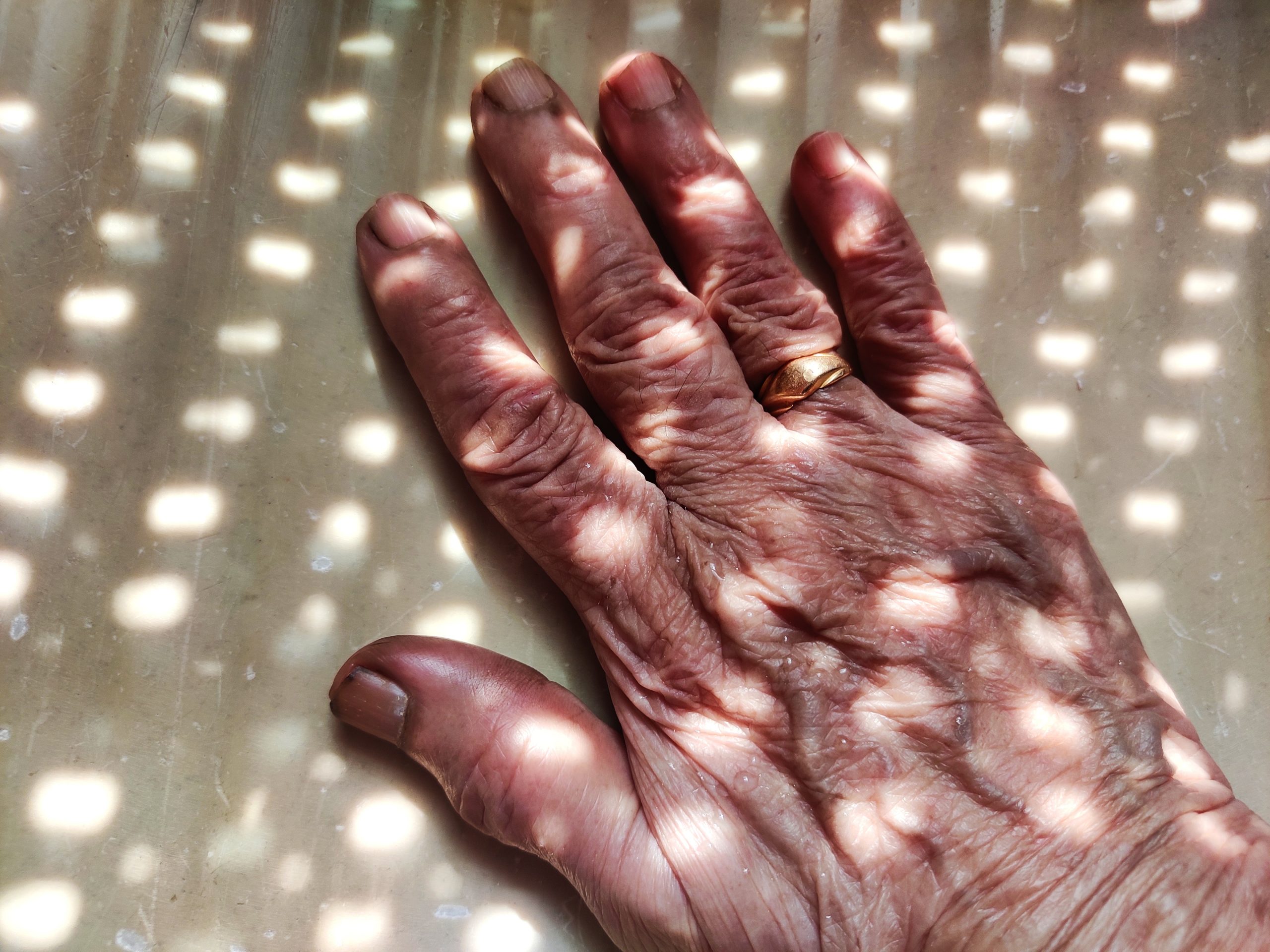 sunlight through a pattern on hand