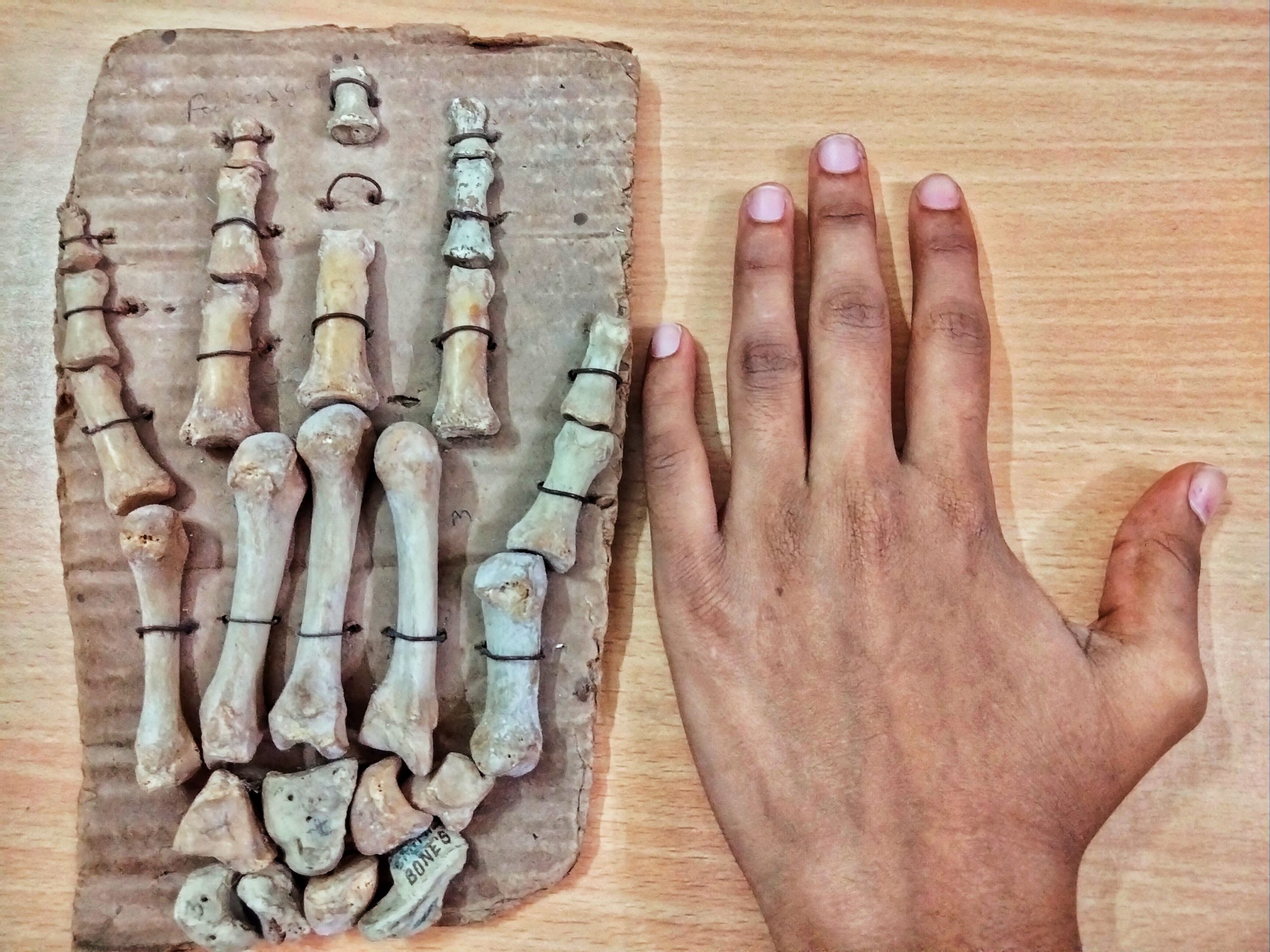 Hand Bone
