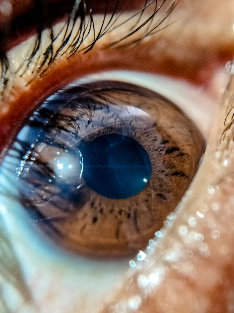 Eye in focus - PixaHive